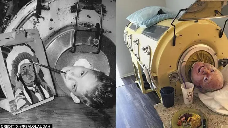Meet Paul Alexander, the polio patient who has spent over 7 decades inside an iron lung polio paul