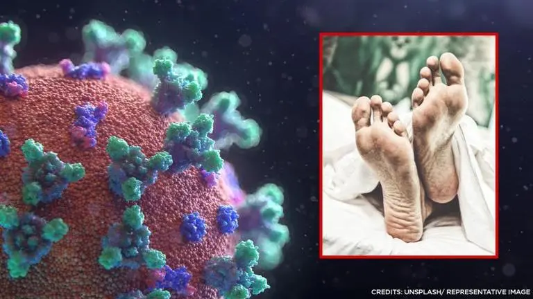 People getting 'lockdown feet' over year of staying home due to COVID; here's what it is (Image Credits: Unsplash/RepresentativeImage)