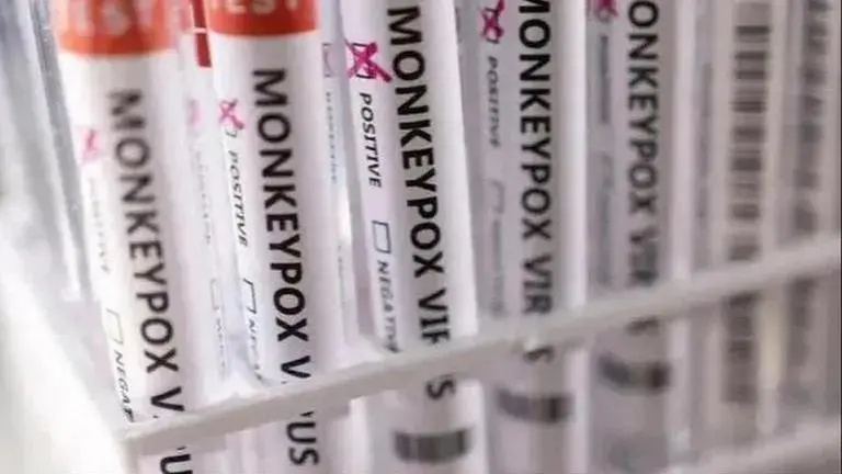 Centre's guidelines for monkeypox patient: 21-day isolation, keeping lesions fully covered Monkeypox