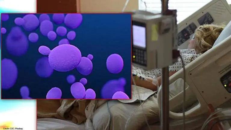 US: Deadly fungus rampantly spread at COVID ward of Florida hospital, study finds US: Killer fungus spread rampantly at COVID ward of Florida hospital