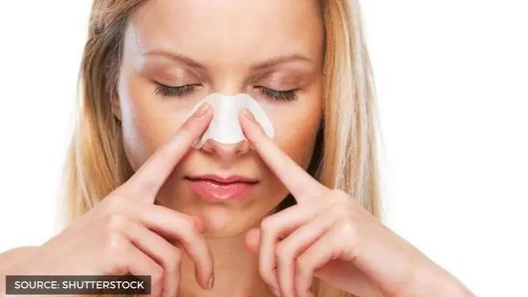 how to avoid blackheads