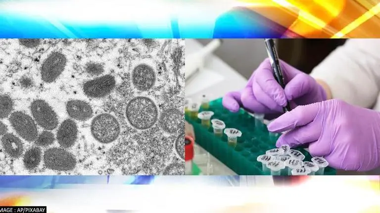 Israel confirms first monkeypox case; govt advises foreign returnees to get tested Israel