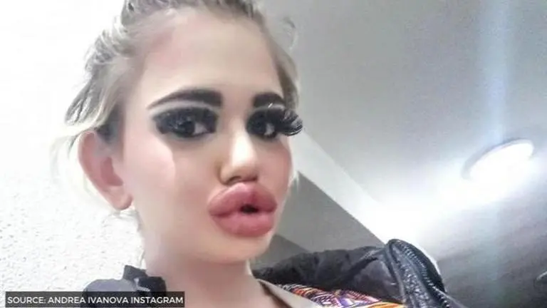 WORLD'S BIGGEST LIPS
