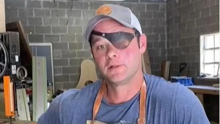 What happened to the guy's eye on 'Fixer to Fabulous', how did Chase Looney lost his eye? what happened to the guy's eye on fixer to fabulous