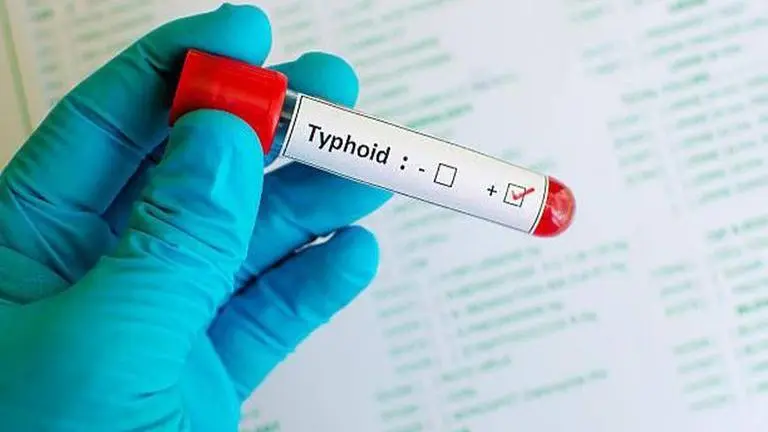 Typhoid-causing bacteria have become increasingly resistant to essential antibiotics: Lancet study typhoid