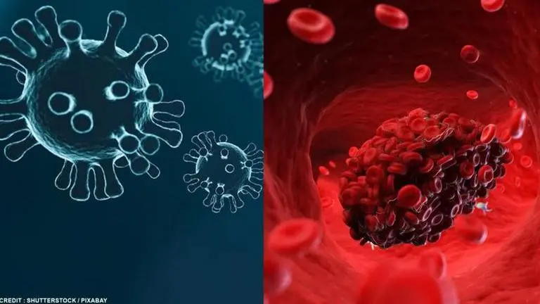 'COVID not just a lung disease': Experts say 'dangerous blood clots observed in patients' COVID