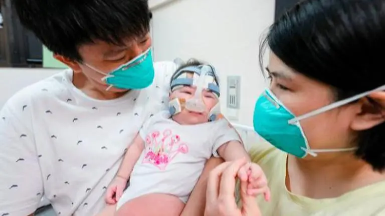 World’s tiniest baby goes home after 13-month stay in hospital, now weighs healthy 6.3kg World's tiniest baby