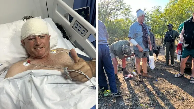 Former Zimbabwe cricketer narrowly escapes death in harrowing leopard encounter-PHOTOS REVEALED Guy Whittal after leopard attack