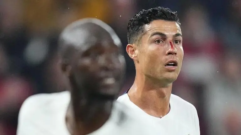 Cristiano Ronaldo left dazed with bloodied nose after ugly collision with goalkeeper Cristiano Ronaldo nose, UEFA Nations League, Portugal