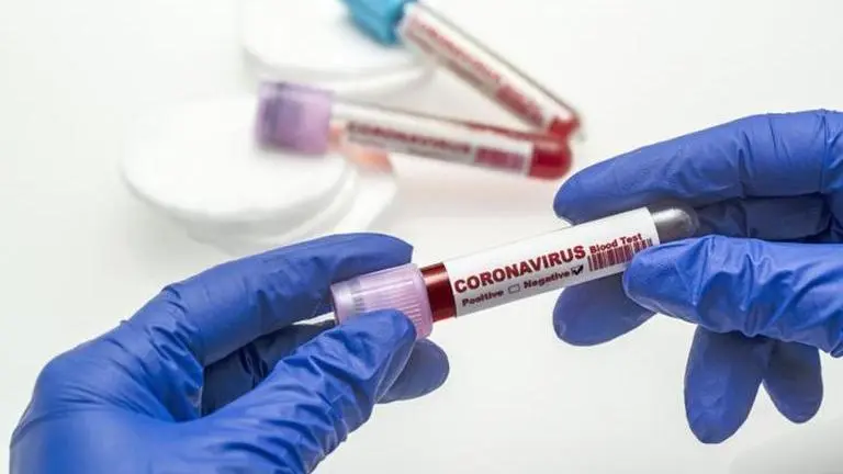 Three more COVID deaths in U'khand; caseload rises to 7,447