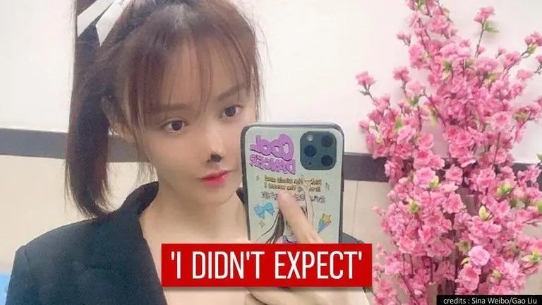 'Nightmare': Chinese actor shares story of cosmetic surgery on nose gone wrong; see pics Chinese