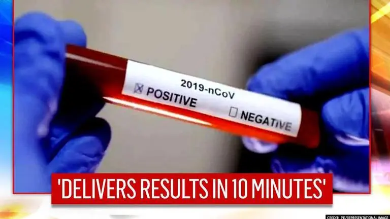 South Korea's Celltrion gets US FDA authorisation for COVID-19 test kit South Korea