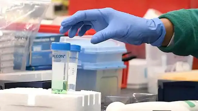 Indore starts rapid antigen tests, gets 12,500 kits from govt