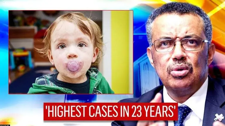 Measles killed 207,500 people in 2019, low vaccine coverage main reason behind deaths: WHO