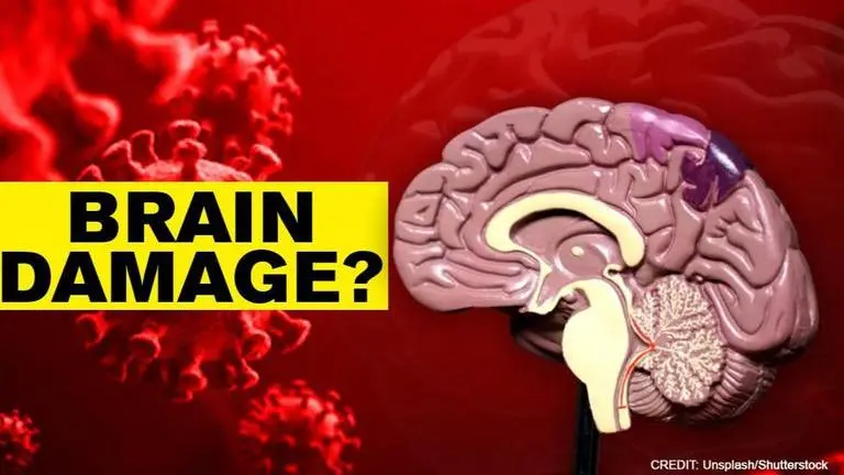 Coronavirus could induce a potential wave of brain damage: Researchers COVID-19