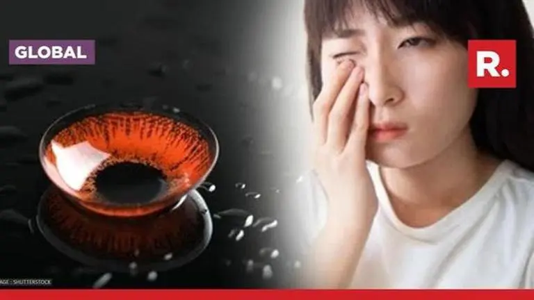 What is Acanthamoeba keratitis? Rare & deadly eye infection that cost 21-yr-old his vision contact lenses