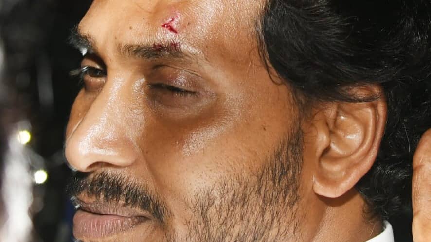Stone Attack Stone Attack Injures AP CM Jagan Mohan Reddy in Vijayawada, PM Modi ...