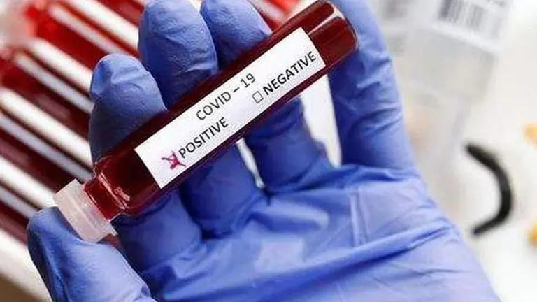 COVID-19: UK returnee woman tests positive in Jabalpur