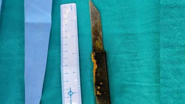 AIIMS doctors remove 20-cm kitchen knife from man's abdomen in 3-hour surgery AIIMS doctors