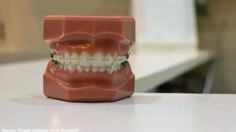 Food to avoid for people wearing braces