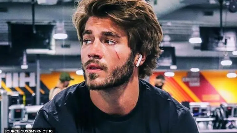 Why does gus from floribama shore have a scar on his face