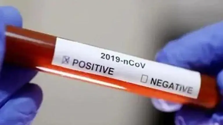 Pakistan records 747 new coronavirus cases, tally reaches 288,047