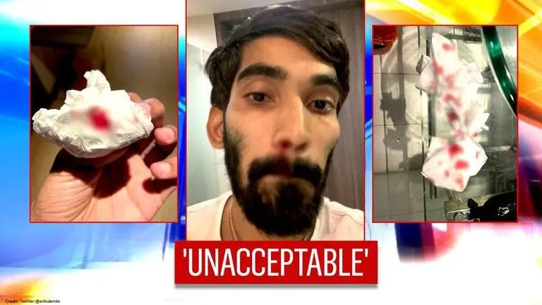 Thailand Open: Kidambi Srikanth made to undergo 4 COVID tests; shares images of nose bleed Kidambi Srikkanth