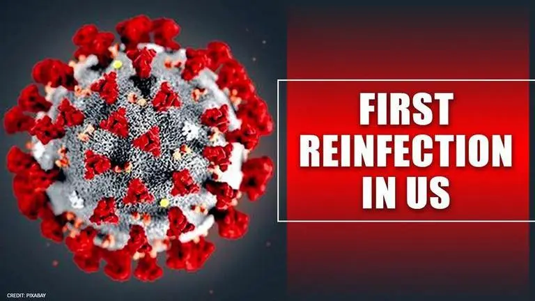 Nevada man may be 1st virus reinfection in US