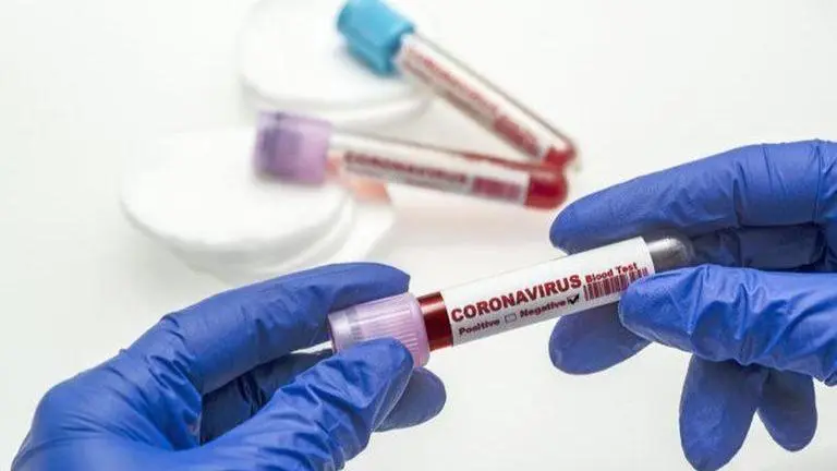 Ahmedabad adds 163 new COVID-19 cases; 168 recovered in day