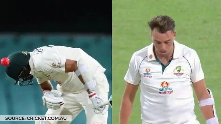 Harry Conway concussion