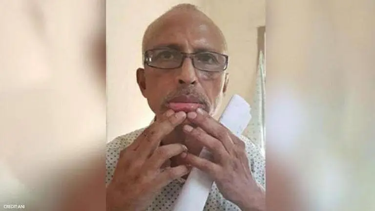 Andhra Pradesh: Suspended Dr.Sudhakar discharged from mental hospital following HC orders Andhra Pradesh
