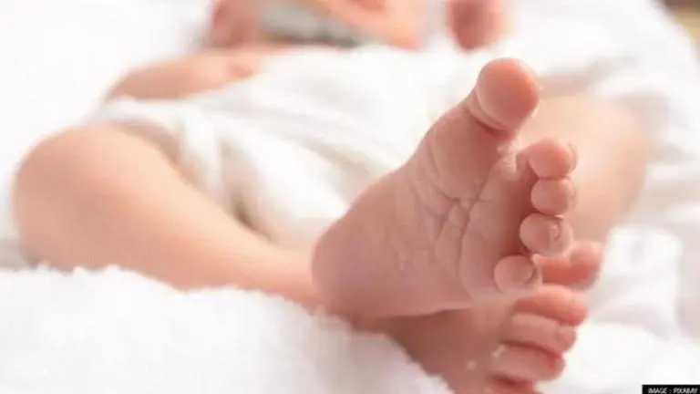 In Brazil, Infant born with 12cm rudimental tail in Albert Sabin hospital stuns doctors Brazil