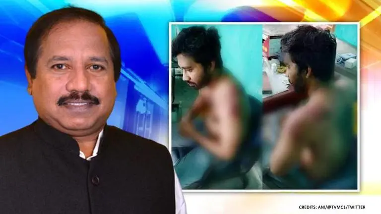IMA President demands 'protective zones' in hospitals after Assam doctor assault incident IMA President