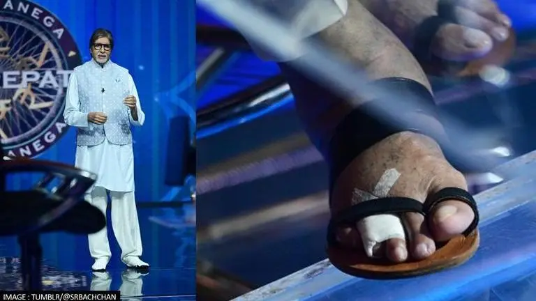 KBC 13: Amitabh Bachchan shares pic of fractured toe, says 'pain is excruciating' KBC 13, Kaun Banega Crorepati, Amitabh Bachchan, Amitabh Bachchan injures toe