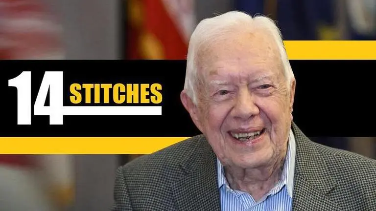 Ex US President Jimmy Carter has black eye, stitches after fall President