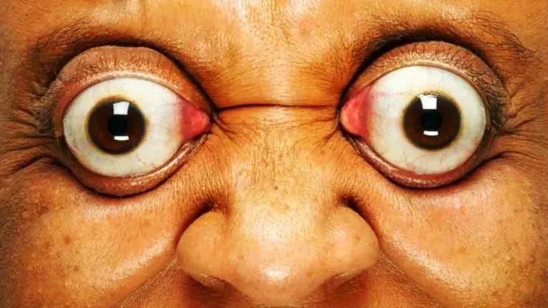 Brazilian man sets new Guinness World Record for farthest eyeball pop Guinness World Record