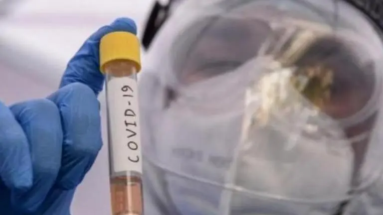 156 more test positive for COVID-19 in Uttarakhand