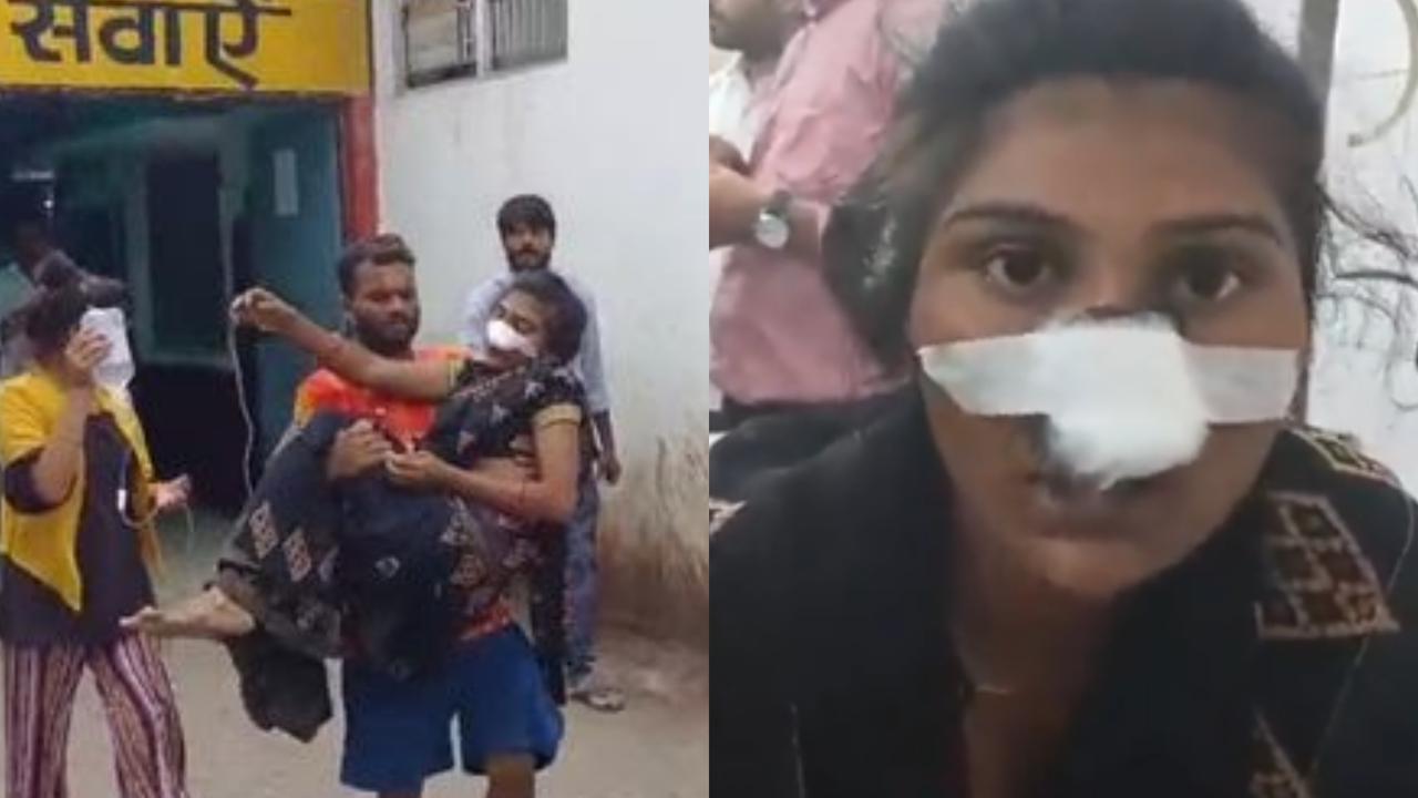 Husband Cuts Wife's Nose in Hardoi, Uttar Pradesh