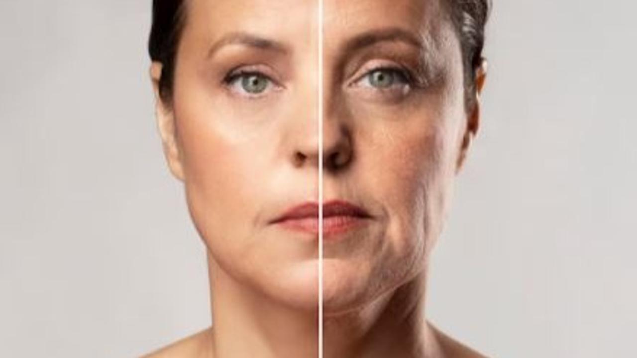 Skin aging sign