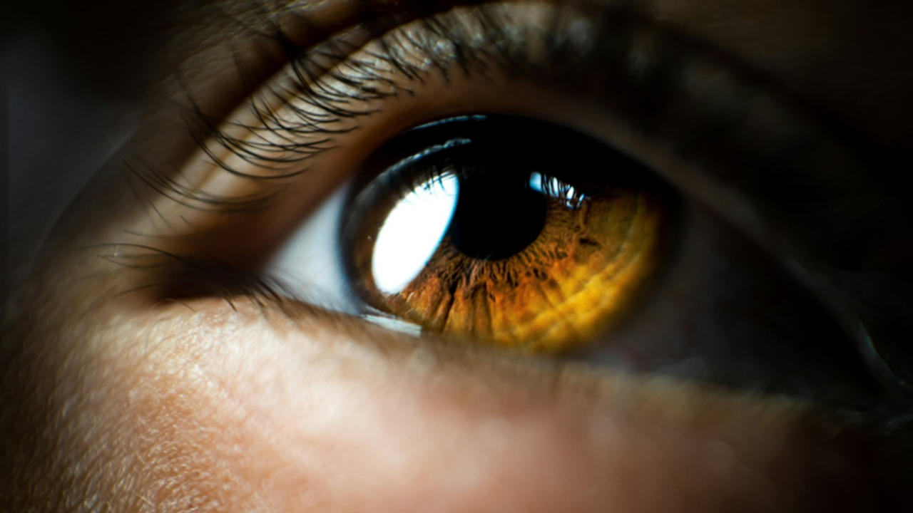 Ring in your Cornea is a warning sign of heart attack.