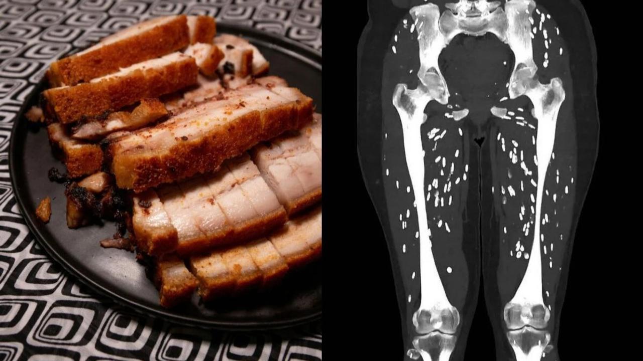  shocking CT scan 