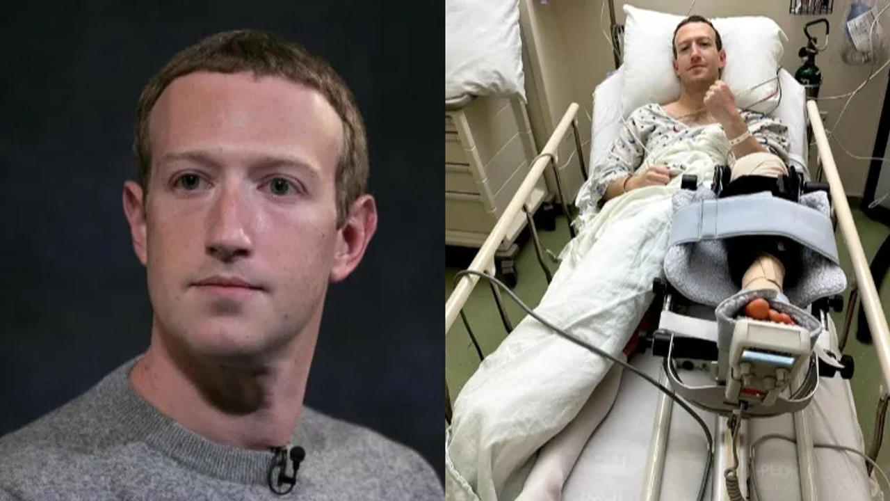 Mark Zuckerberg is out of MMA action and has undergone surgery