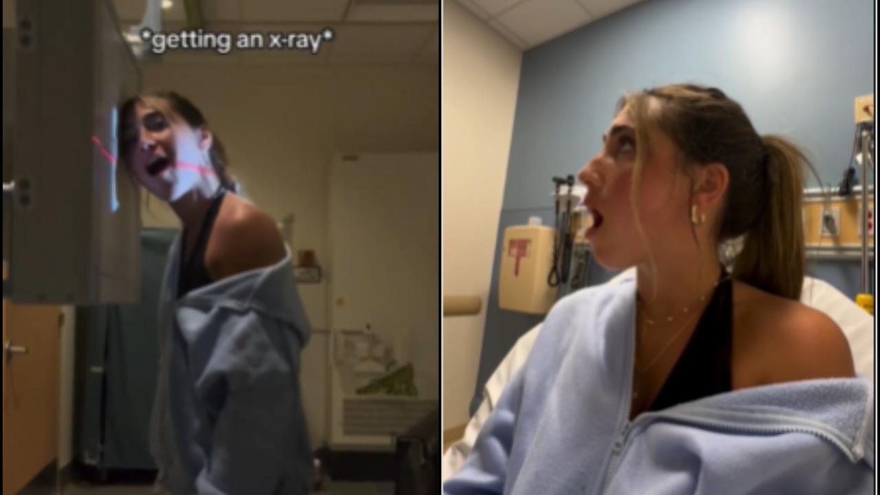 Viral Video: US Influencer Got Her Jaw Stuck After yawning Too Hard