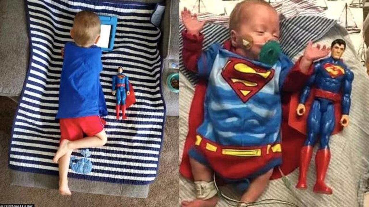 Baby born the size of superman toy recovers complexities, growing healthy