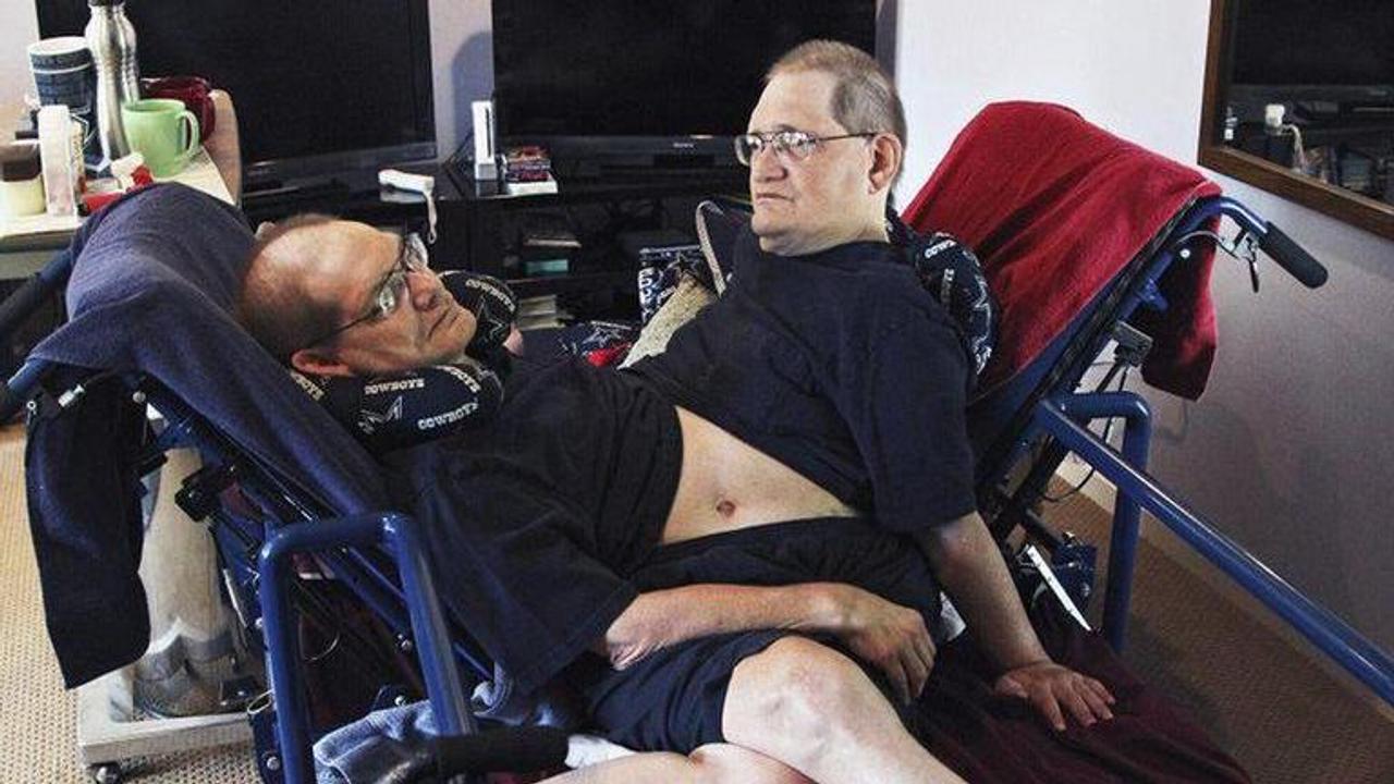 US: World's longest-surviving conjoined twin brothers die at 68