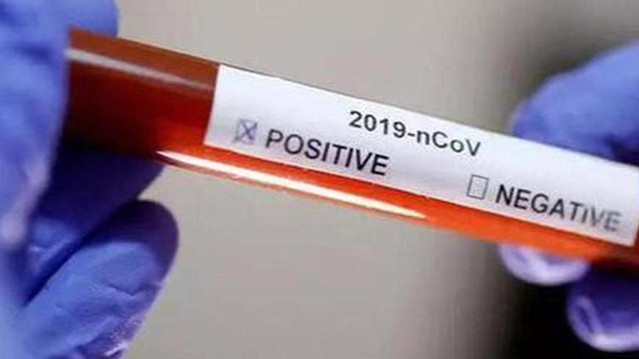 Uttar Pradesh: Ward boy at Firozabad hospital tests COVID-19 positive