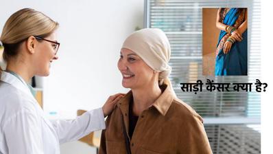 Petticoat Cancer kya hota hai