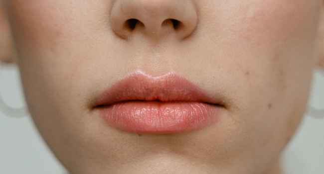 Plumped Lips Without Filler Or Other Injections? Here’s What An Expert Says