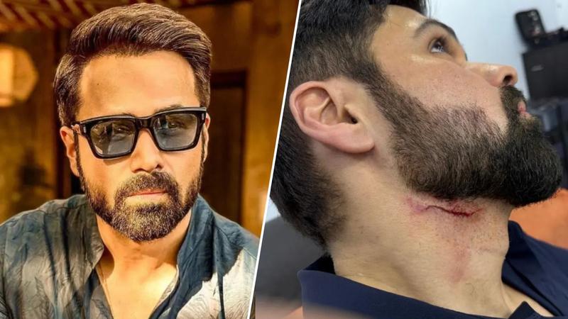 Emraan Hashmi injured on the sets of Goodachari 2