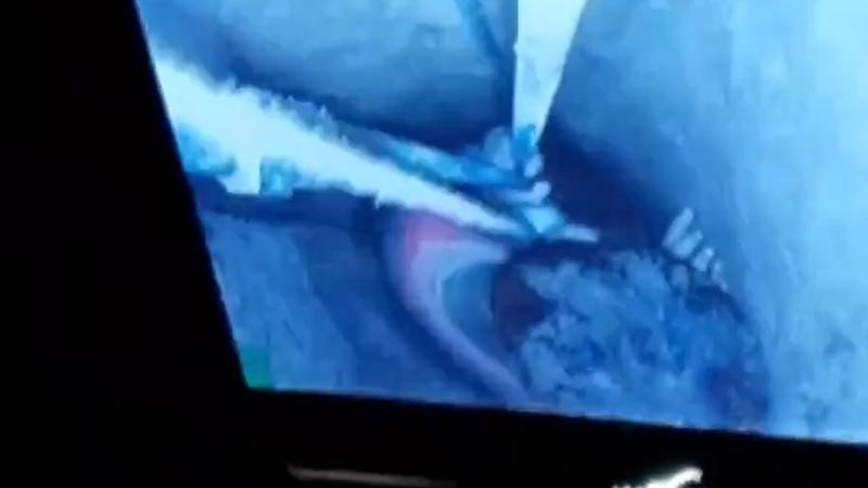 girl falls into borewell